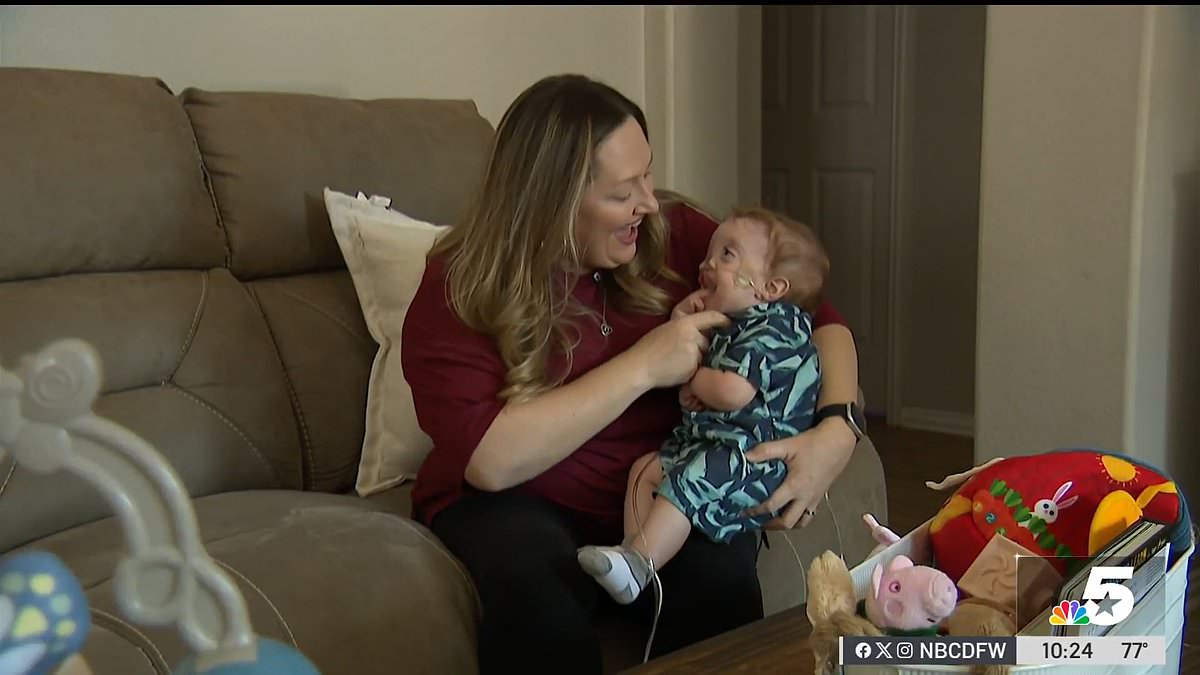 Texas infant with rare birth defect set for transformative facial surgery