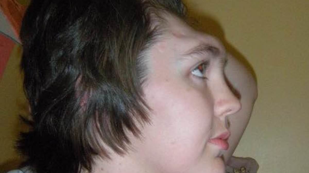 Woman who lost her forehead in 2006 crash reveals transformation after years of reconstructive surgery