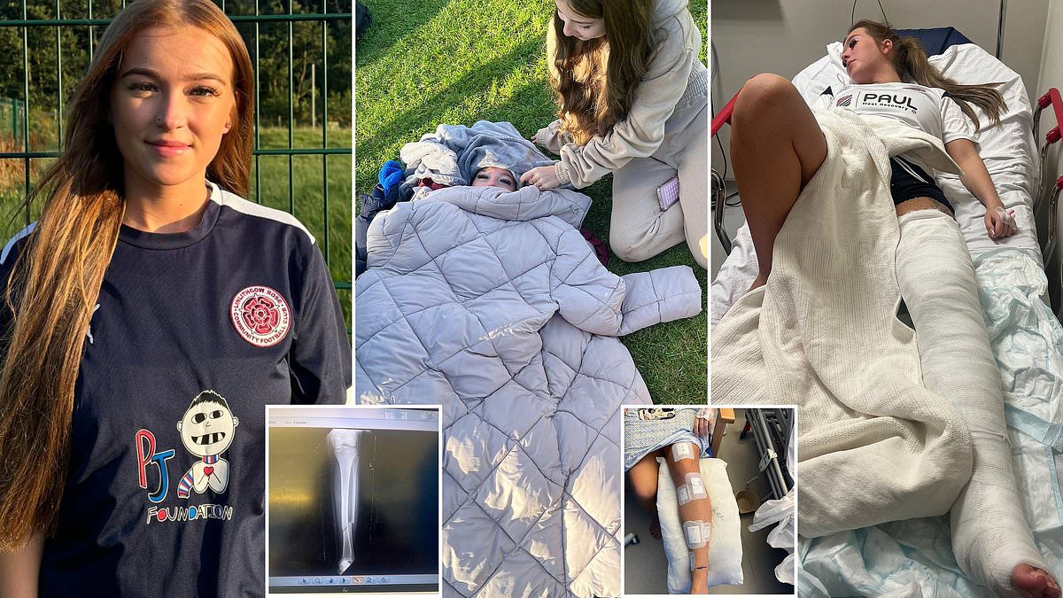 Footballer waits five hours for ambulance after on-pitch injury