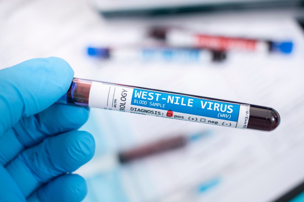 blood samples and test tubes