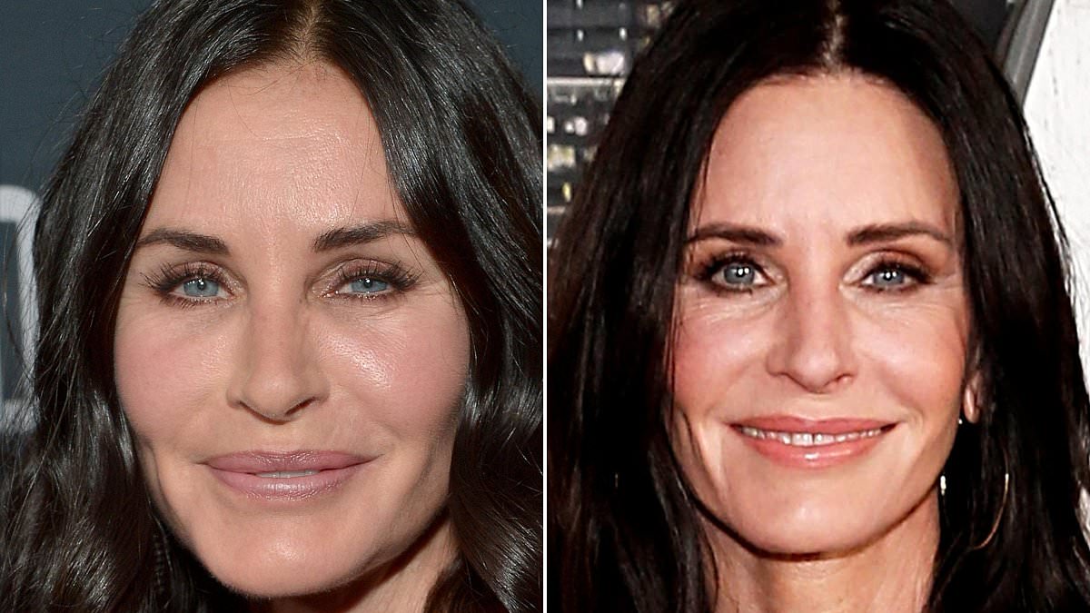 Alyssa Milano leads celebrities in reversing plastic surgery as demand for natural looks grows