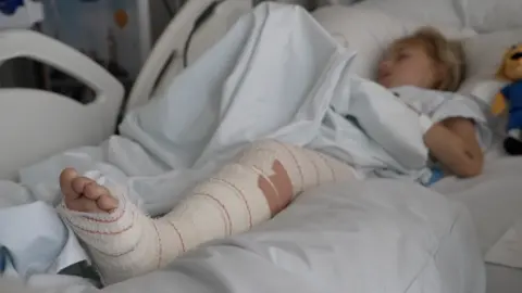 Surgeons say rising e-bike injuries are placing heavy burden on hospitals