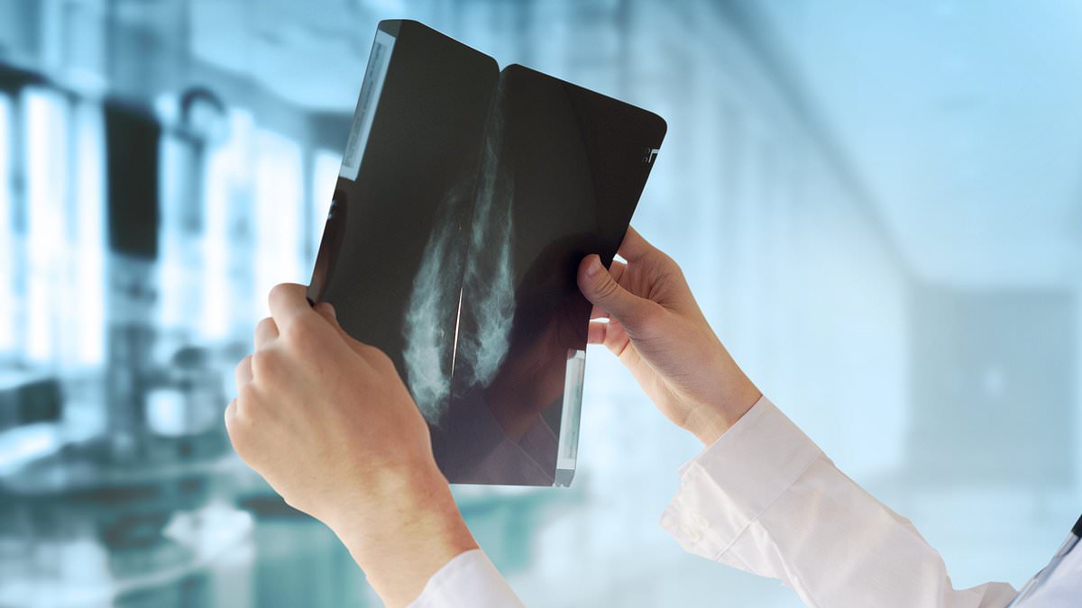 AI trained on mammograms predicts heart attack and stroke risk, study finds
