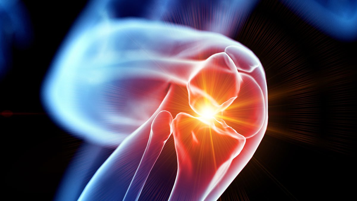 Six steps to ease knee osteoarthritis pain and delay surgery, experts say