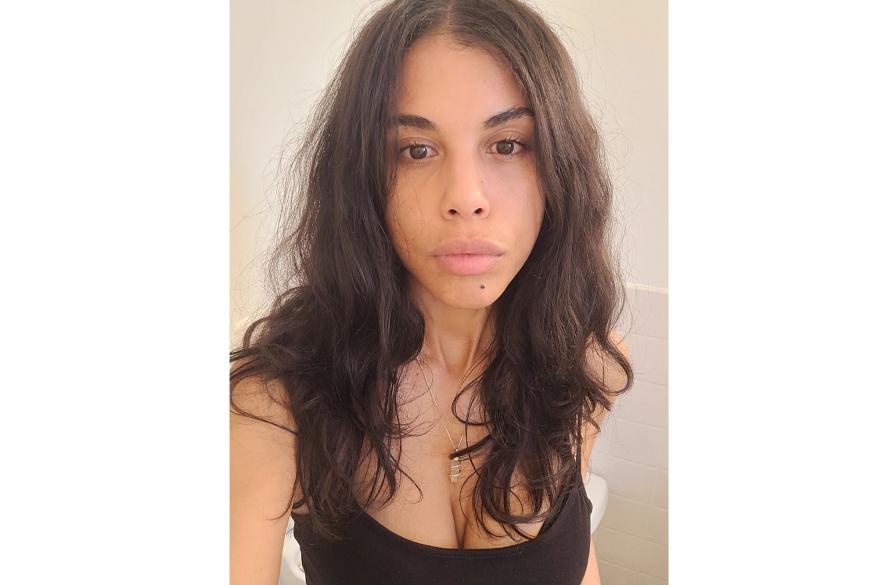 After treatment results