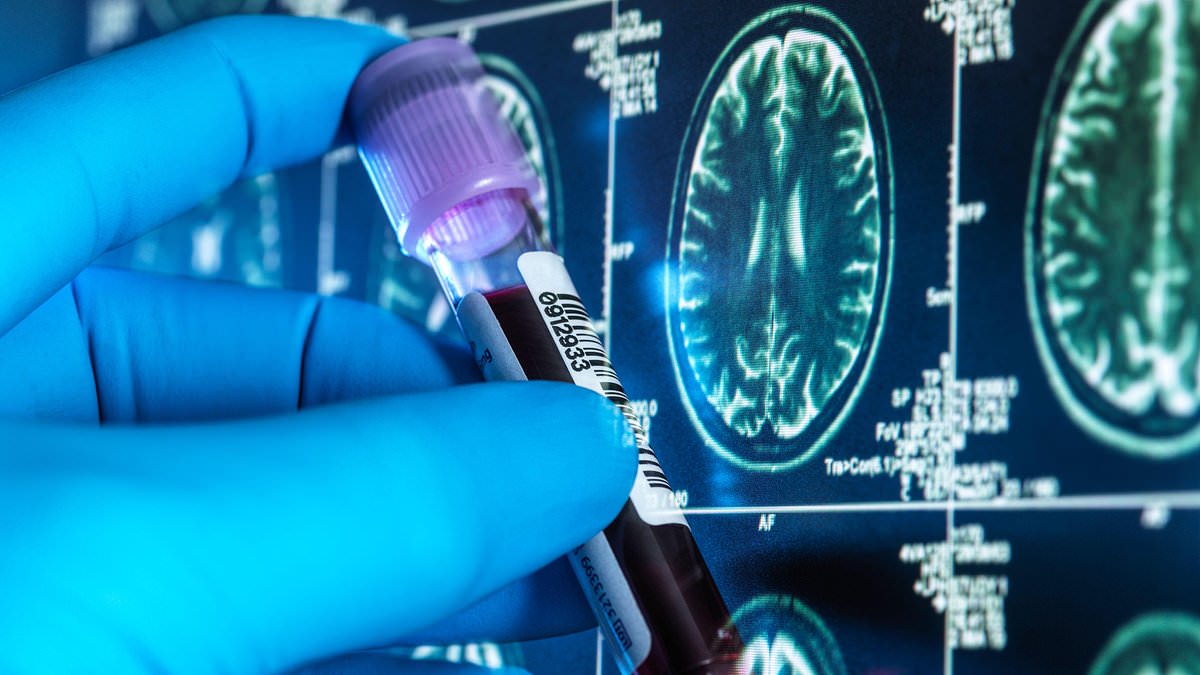 Thousands of Britons to receive cheap Alzheimer's blood tests in landmark NHS trial