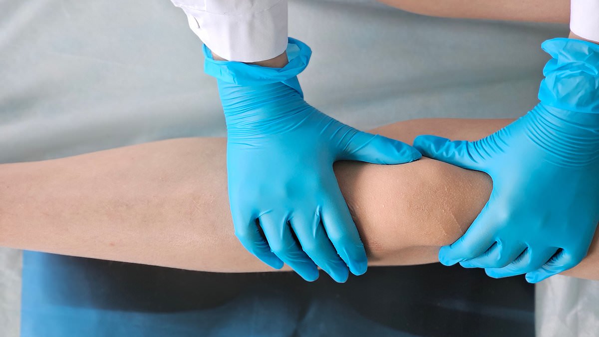 Cosmetic leg shortening draws interest as more seek height reduction in Turkey