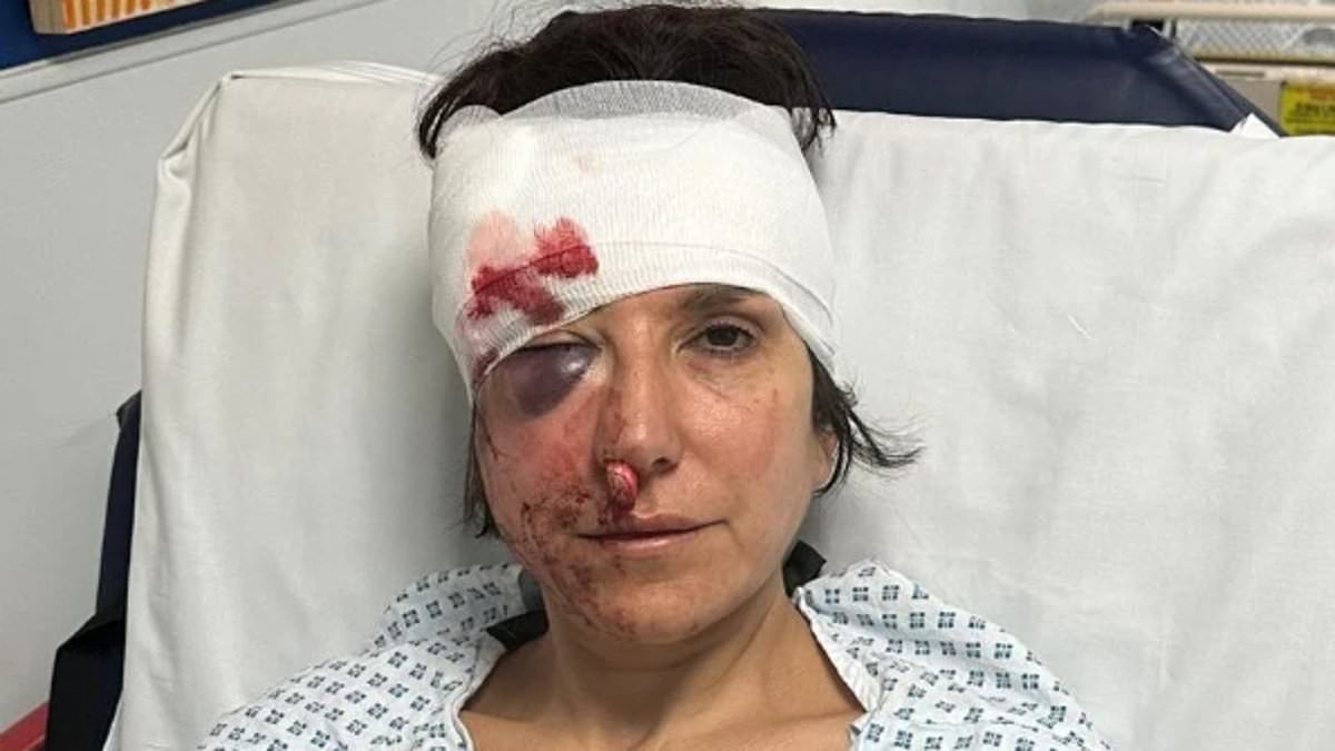 Cyclist fined £500 after Regent's Park collision left pedestrian with facial fractures
