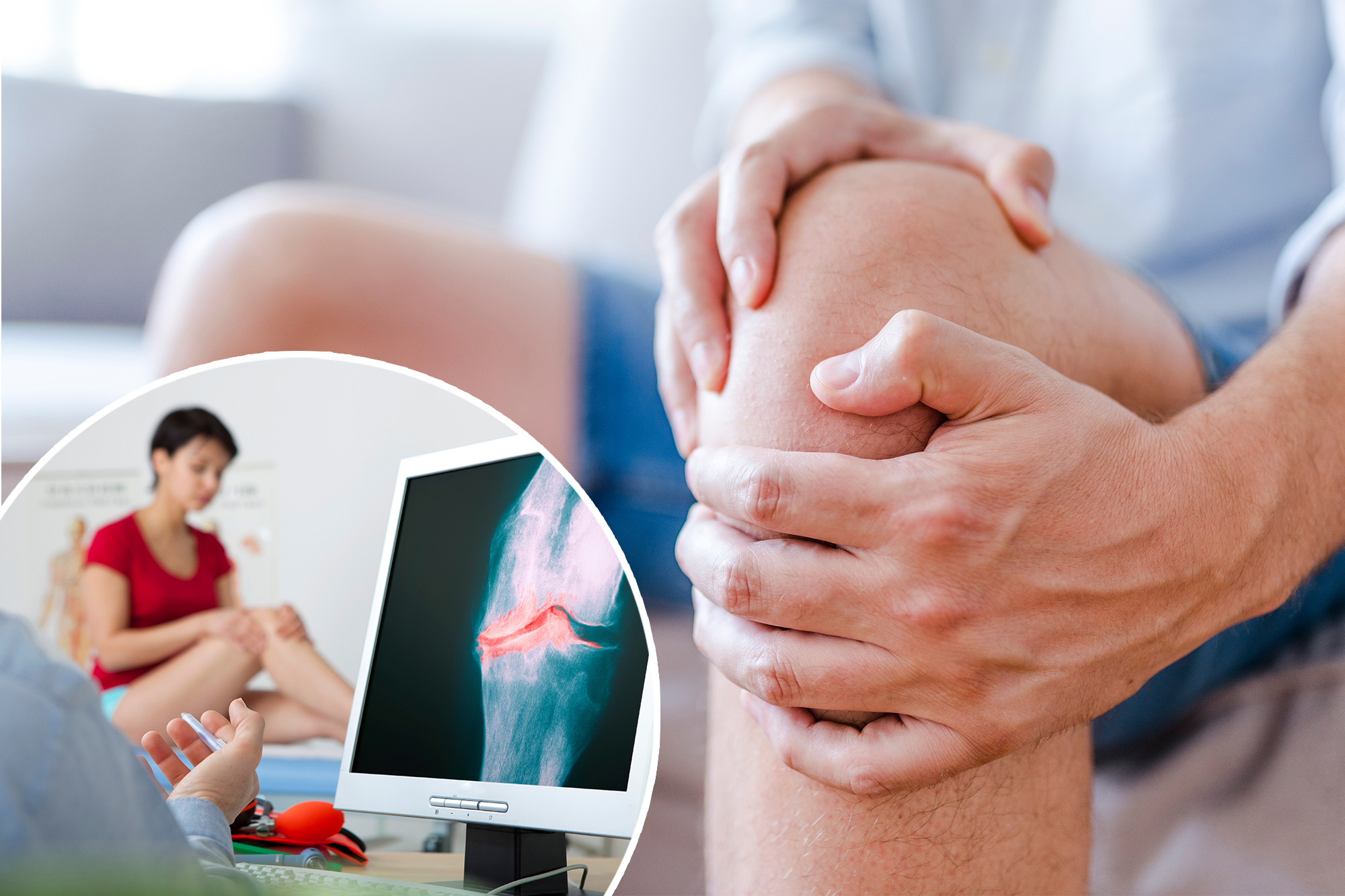 Knee damage increasingly found in younger adults as obesity and sports injuries rise