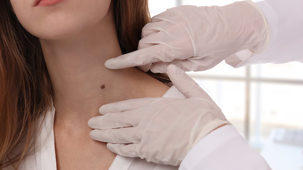 Sun beds for a year to get a 'golden glow' ends in melanoma, says Scottish tattoo artist