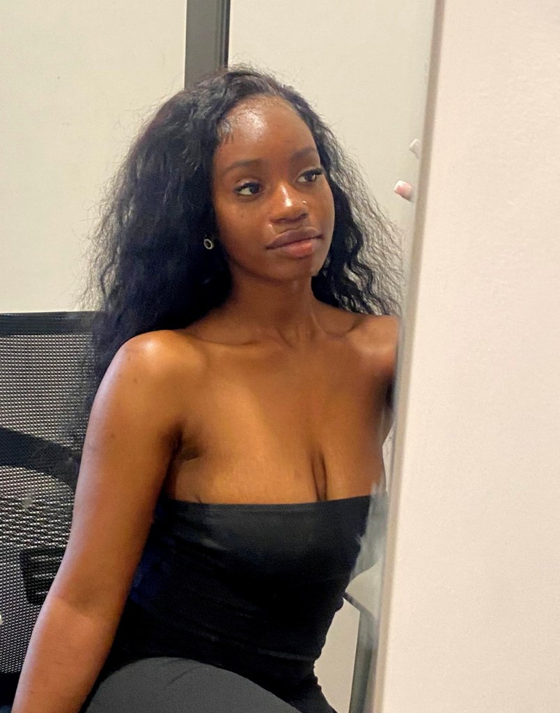 College student has legs amputated after her ‘freshers’ flu’ was actually deadly meningitis