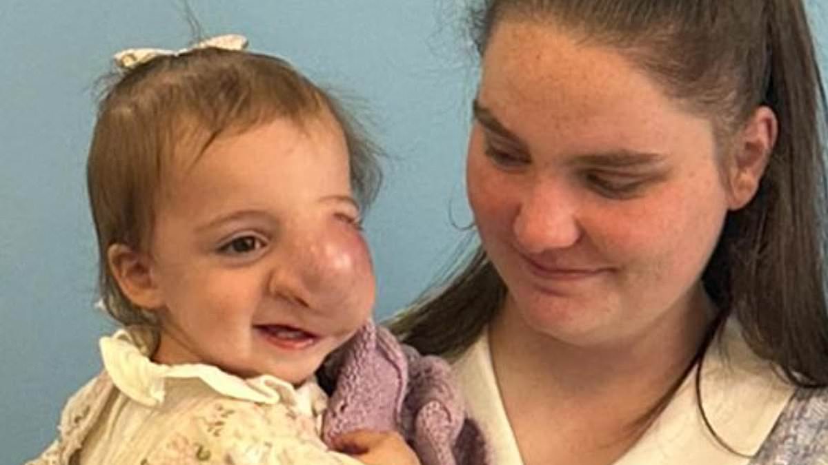 Parents accuse NHS of failures after 19-month-old dies following delayed diagnosis of facial tumour