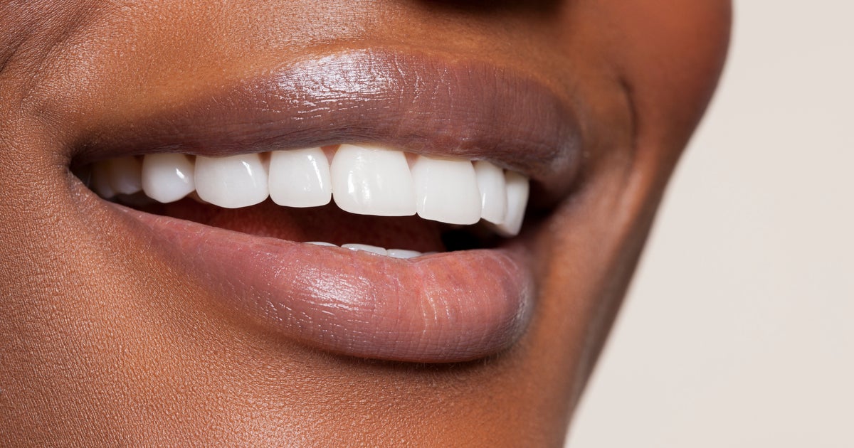 Dentists Say Viral TikTok Teeth-Whitening Hacks Can Be Harmful — Here’s What Is Safe