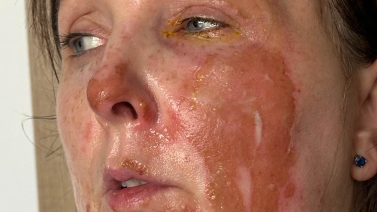 BBC veteran and wife survive fireball as eco-heater explodes, destroying home near Cardiff