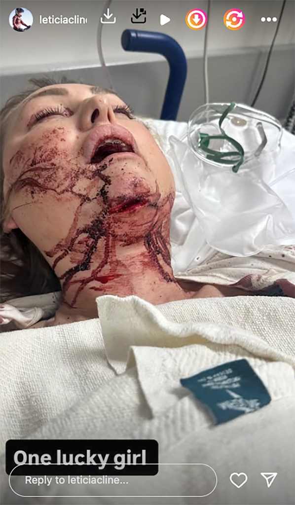 Mike Wolfe discharged from hospital as girlfriend Leticia Cline remains hospitalized after crash