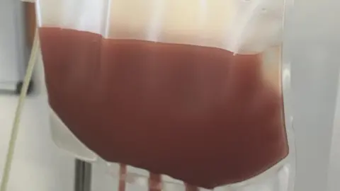 UK's first stem cell collection centre dedicated to transplants opens to donors