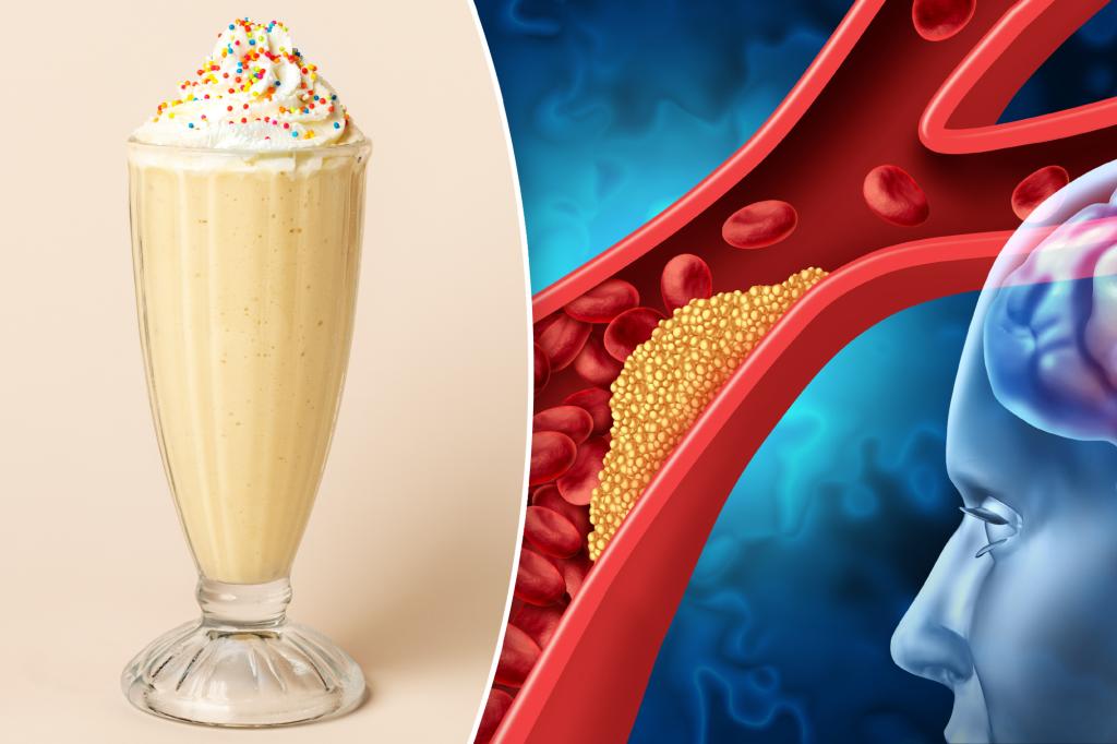 Single milkshake can impair brain blood flow, study finds