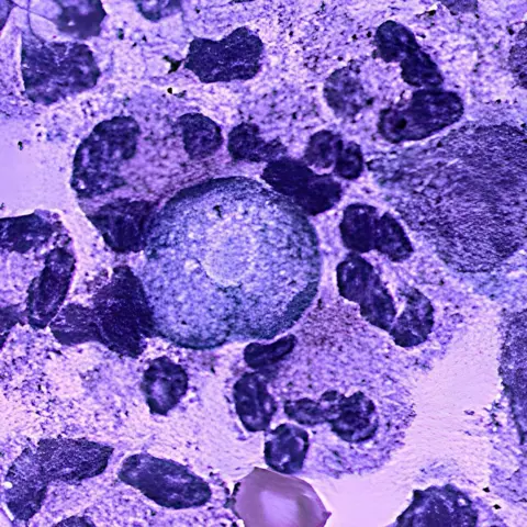 Kerala confronts rising brain-eating amoeba cases with aggressive testing and water-safety measures