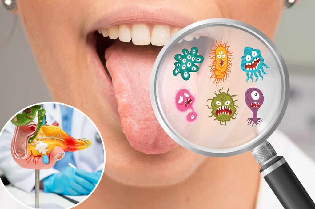 Oral microbiome linked to pancreatic cancer risk, NYU study finds