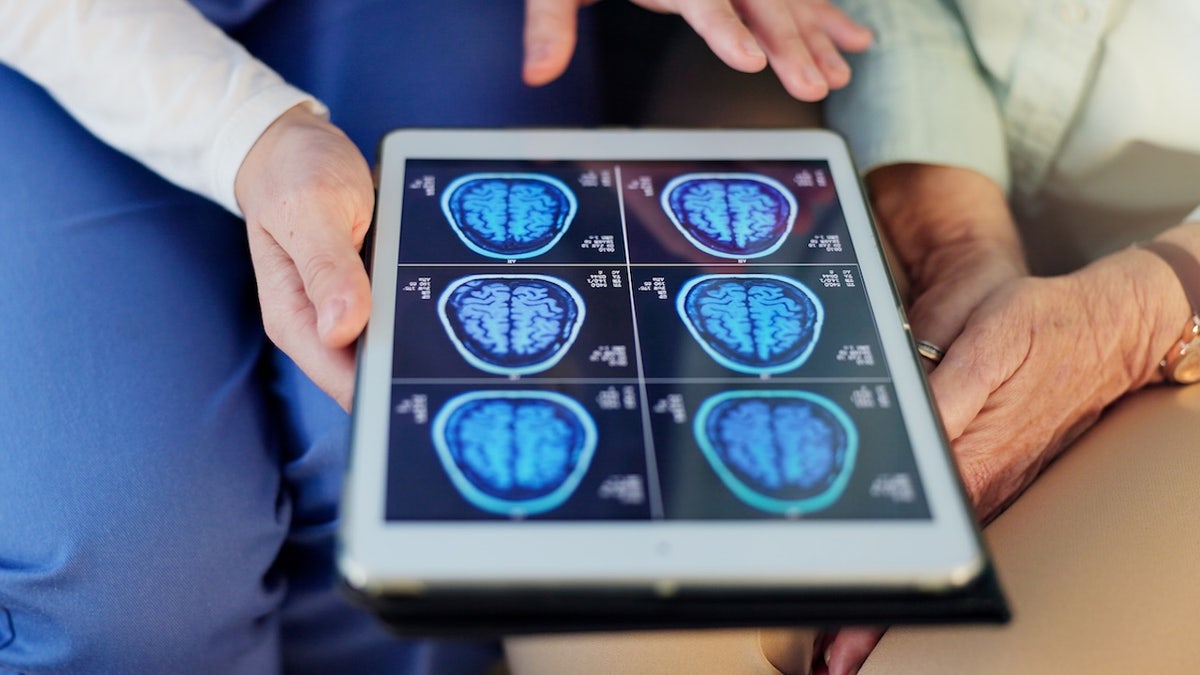 Small study links resveratrol and copper to diminished glioblastoma markers, but experts urge caution