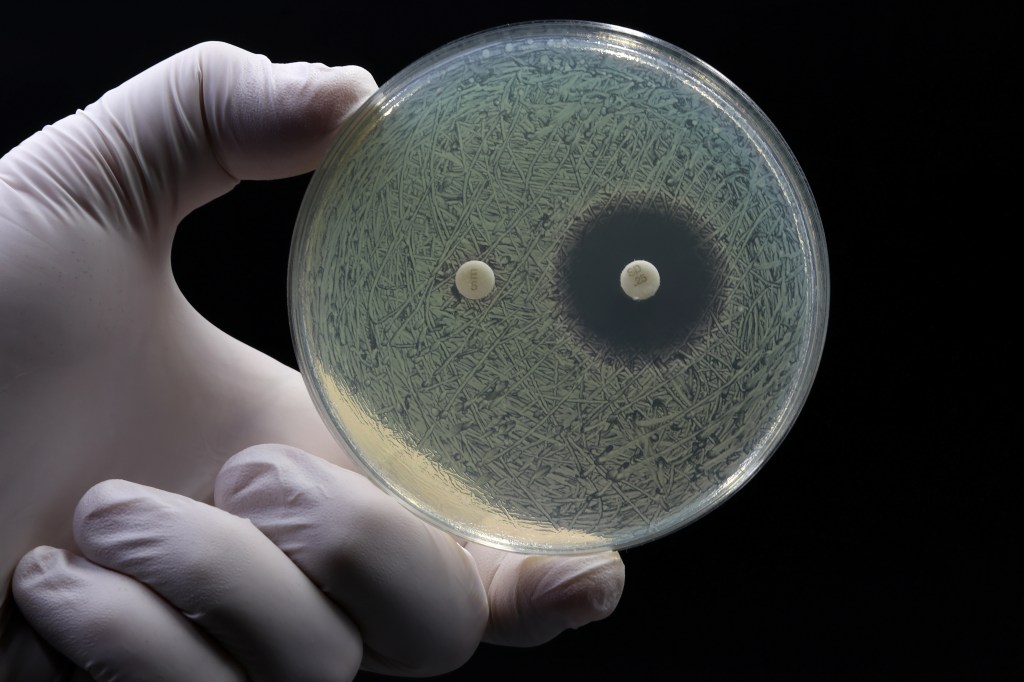 CDC: 'Nightmare' drug-resistant bacteria rising in the U.S.; NDM gene drives surge