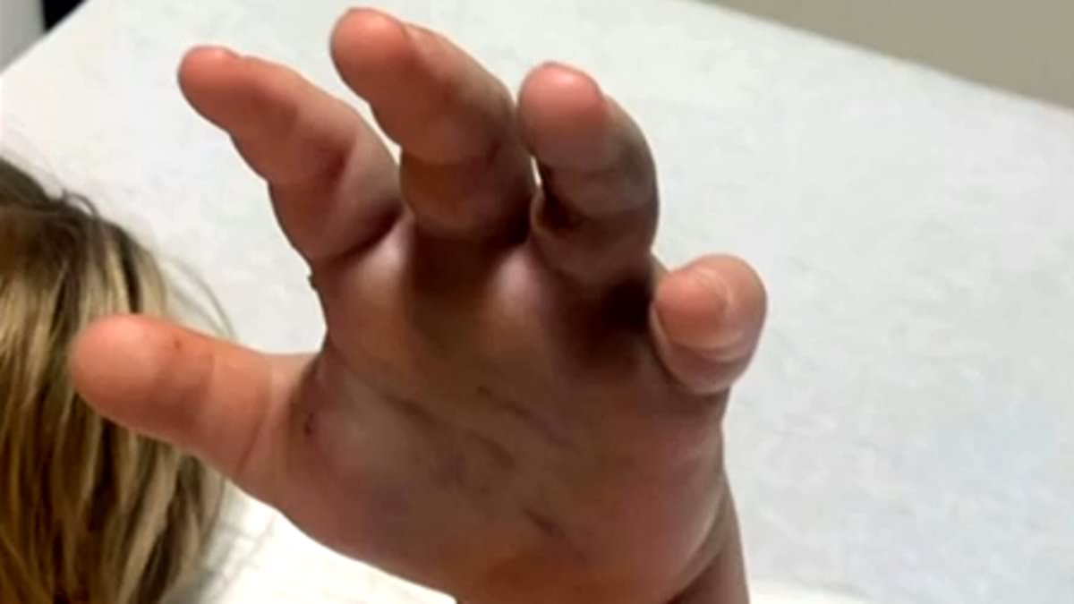 Four-year-old bitten by copperhead at South Carolina daycare; family says staff did not call 911