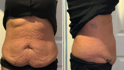 Grace Parkin planning overseas skin procedures