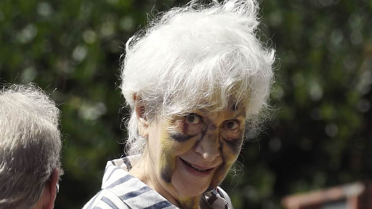 Jennifer Rhodes, 78, seen with apparent bruising during rare Los Angeles outing