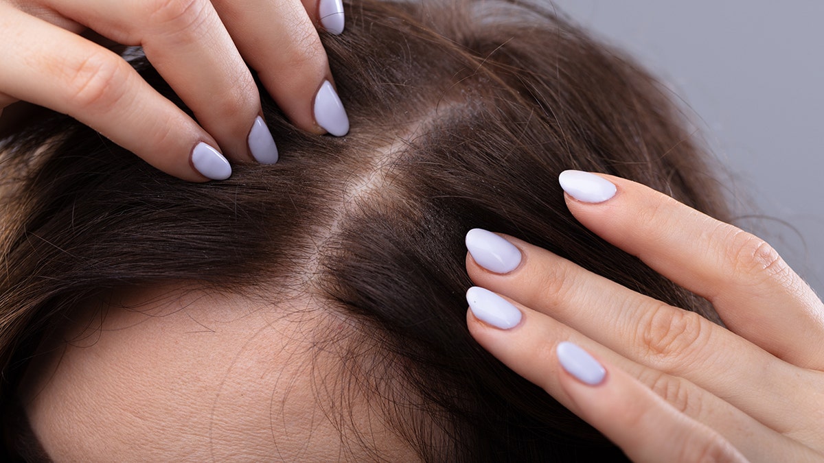 Woman thinning hair and protein diet