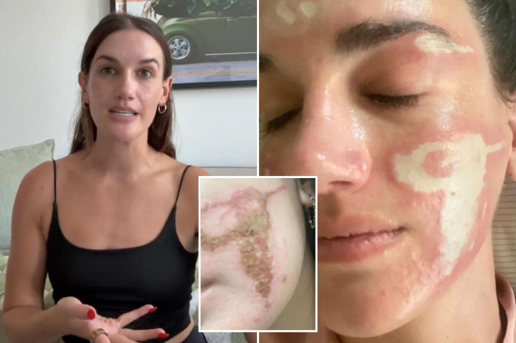 Composite image related to the incident