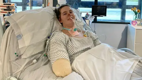 Cardiff medical student prepares for life without limbs after sepsis-related amputations