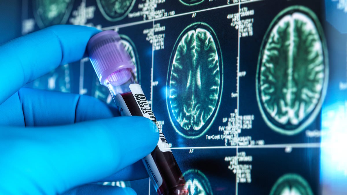 Breakthrough gene therapy slows Huntington's disease progression, study finds