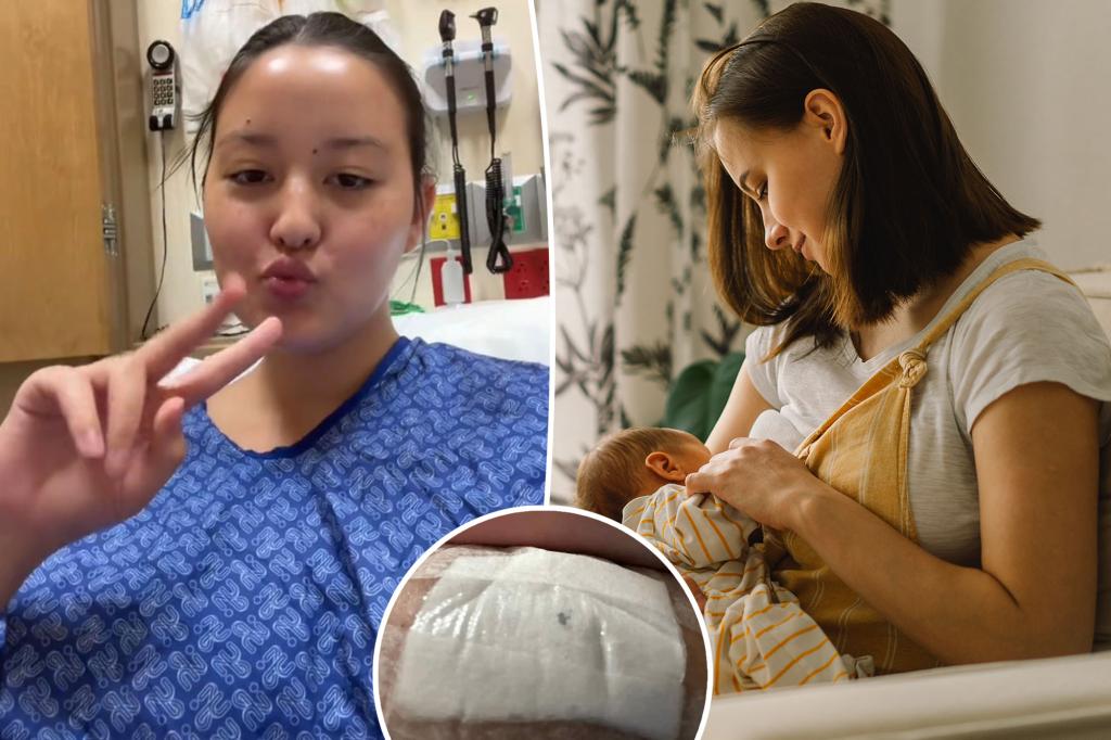 Mom goes to ER after her toddler bites off half her nipple during breastfeeding