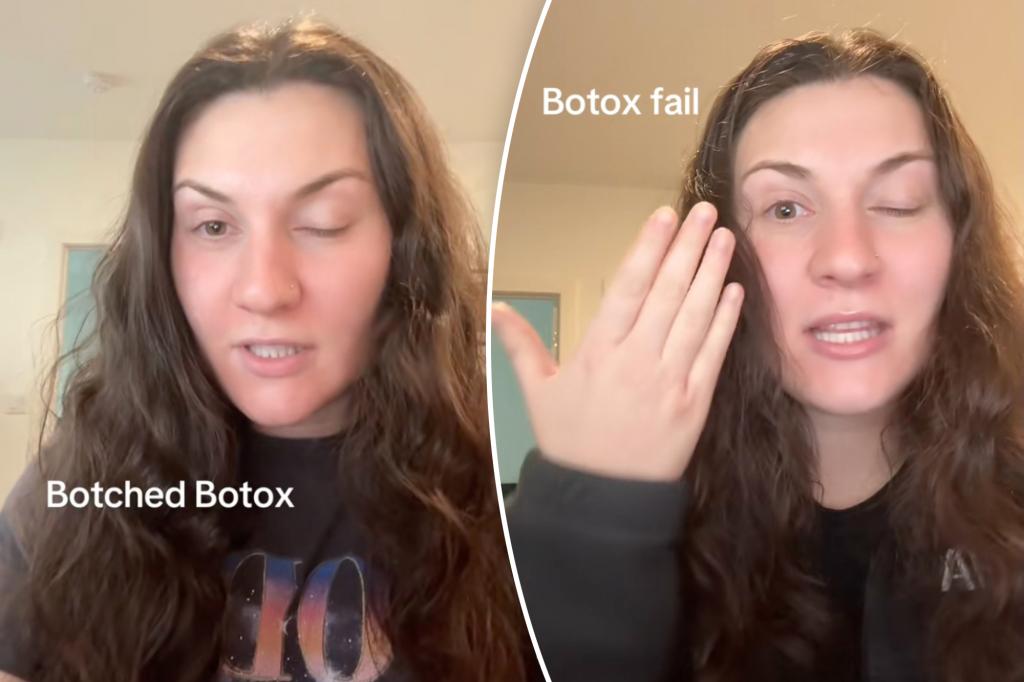 Botox mishap leaves woman with drooping eyelid; TikTok details spark caution