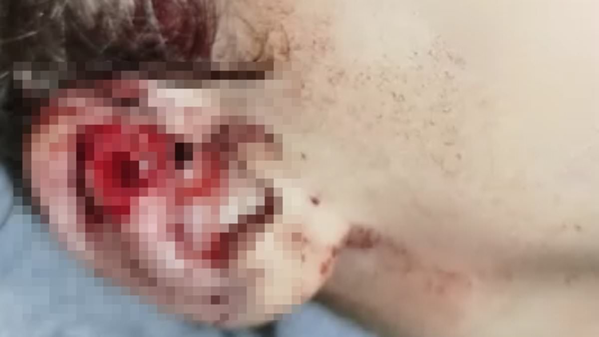 Toddler critically injured after rat attack in Le Havre council flat