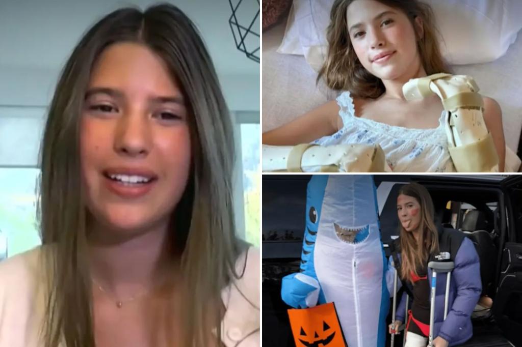 Carlson shark attack reconstruction image