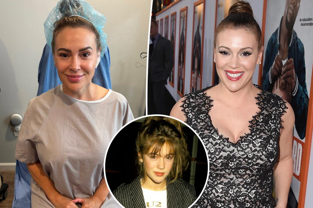 Alyssa Milano Removes Breast Implants, Says She’s Releasing False Narratives and Embracing Her Authentic Self