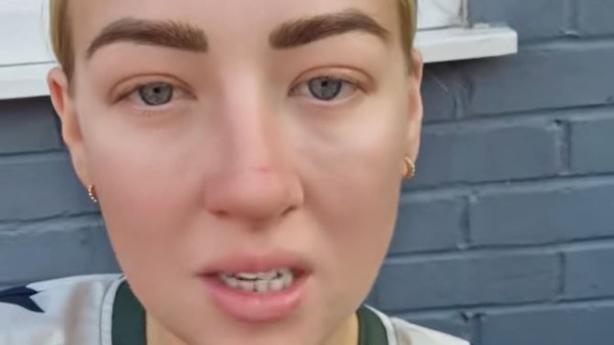 Mother says Mounjaro weight loss left her unhappy, citing excess skin and body-image struggles