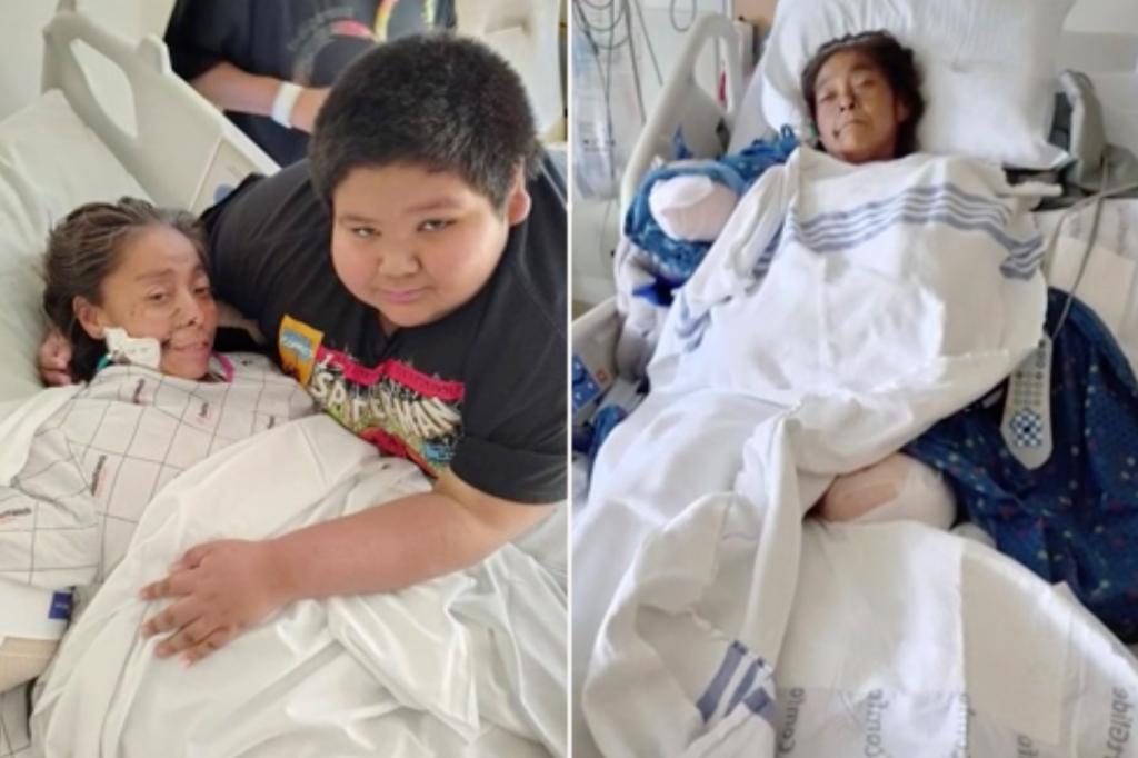 Oklahoma woman loses arms and legs in dog attack as medical bills mount