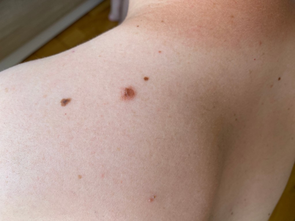 Supplement bottles and vitamin B3