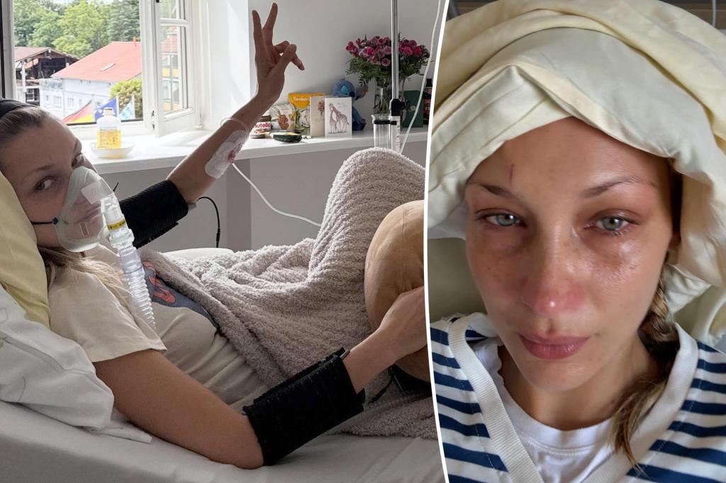 Bella Hadid posts alarming photos from hospital bed as Lyme battle persists