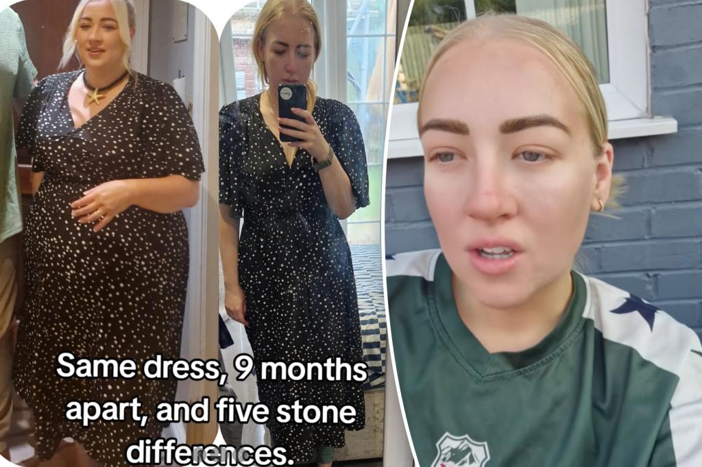 British mother says 84‑pound Mounjaro weight loss left her feeling 'disgusting' because of excess skin