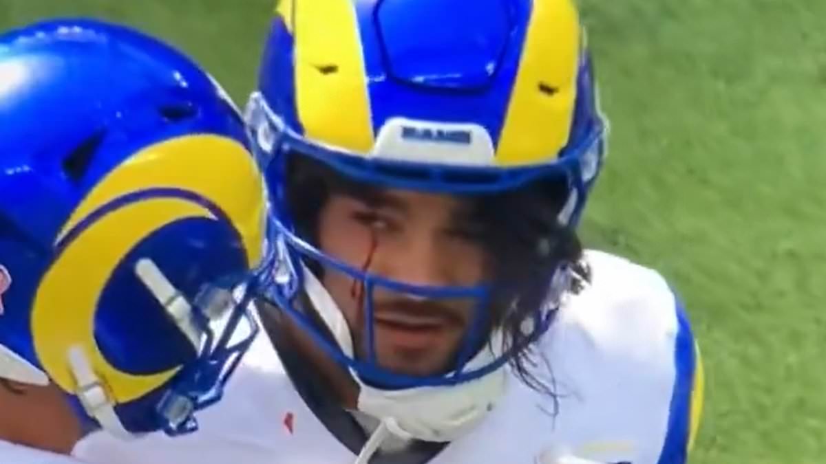 Rams' Puka Nacua Bleeds From Eye After Helmet-to-Helmet Hit, Undergoes Concussion Check