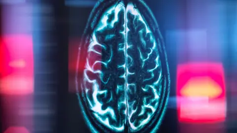 Brain's internal mileage clock identified in rats and humans